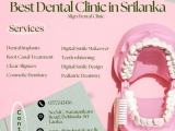 Best Dental Clinic in Sri Lanka - Align Dental